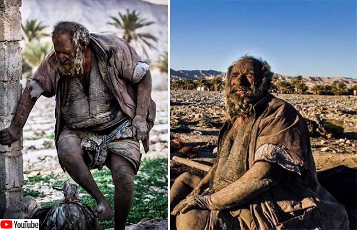 60年以上間風呂に入らなかった高齢男性だが健康状態は極めて良好、医師をびっくりさせる ニコニコニュース