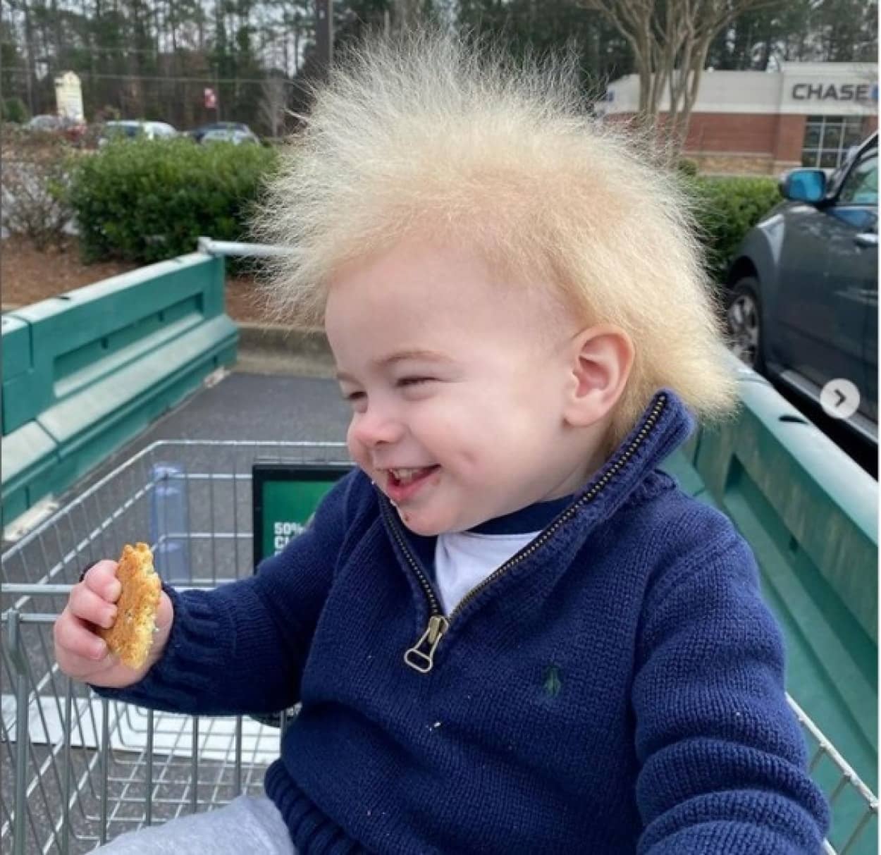 世界で100人だけ髪の毛が逆立ってしまう 櫛でとかせない頭髪症候群 の男の子 ニコニコニュース