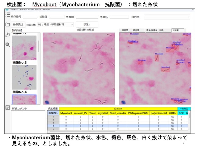 画像が削除されました