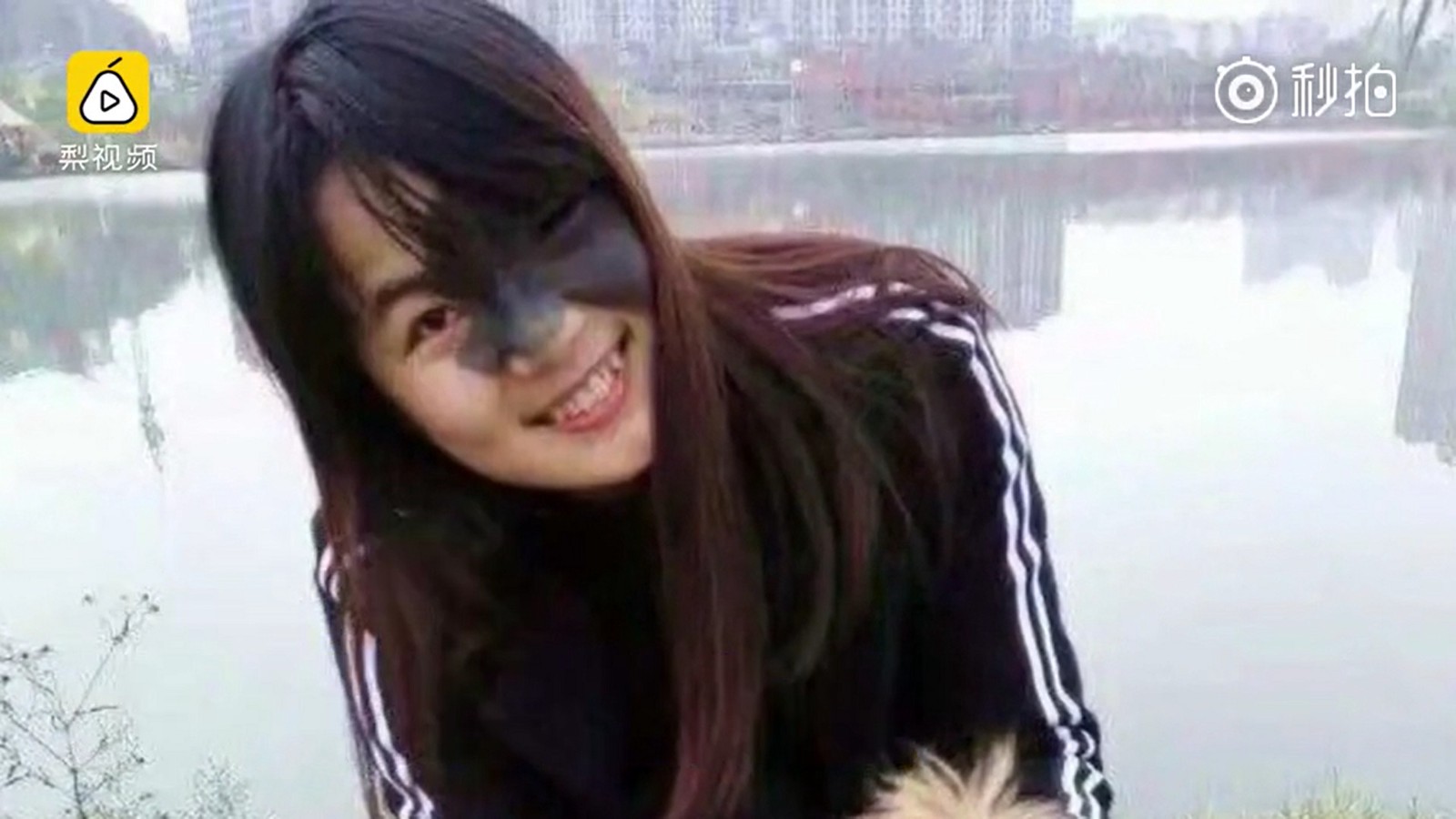 23歳の中国の美女 顔に出来たシミ跡治療のために顔を風船のように膨らますハメに ひょうたん女 と中国で話題に ニコニコニュース