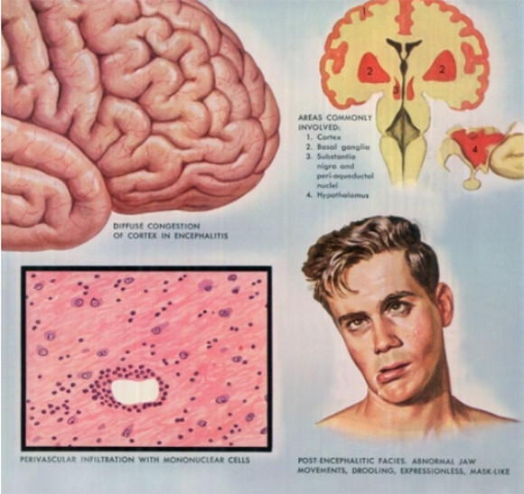 手描きなのに驚くほど精巧 医療画家が描いた病理学イラスト 医療画注意 ニコニコニュース