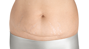 自然分娩は帝王切開分娩より偉いの ニコニコニュース