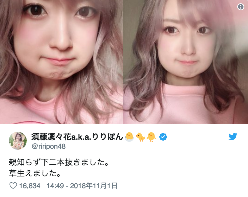 キュートなハム太郎系女子 親知らずを抜いてぷっくりしちゃった女子たちを一挙に ニコニコニュース