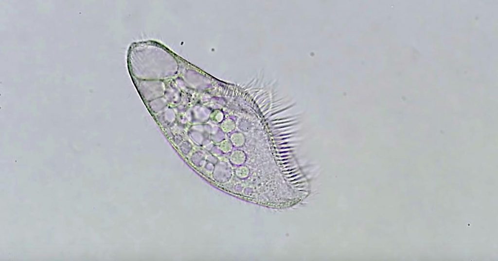 単細胞生物が 命を終え無に帰す瞬間 の動画が悲しいと話題に 身体を繋ぎ止めていた 命 が無くなった瞬間バラバラに崩壊し ニコニコニュース