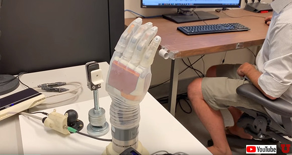 触れたものの感覚がわかる 触覚を持った義手で17年ぶりに妻の手を感じることができたという男性 米研究 ニコニコニュース