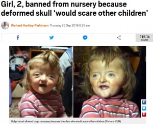 他の子が怖がる 頭蓋骨変形の2歳女児の入園を保育園が拒否 露 ニコニコニュース