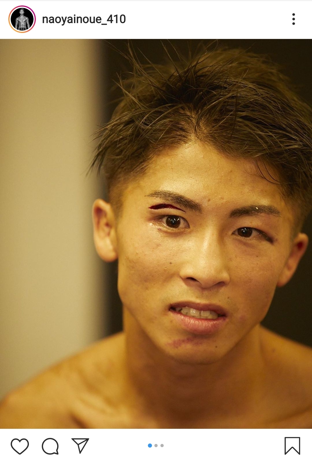 激闘を制した井上尚弥の 傷痕ショット に称賛続々 最高の男 一生応援します ニコニコニュース