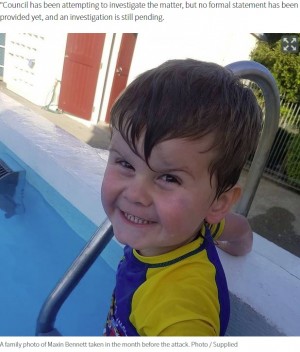 親戚の飼い犬に顔を噛みちぎられた2歳児 頬が裂け歯が見えていた と母 ニュージーランド ニコニコニュース