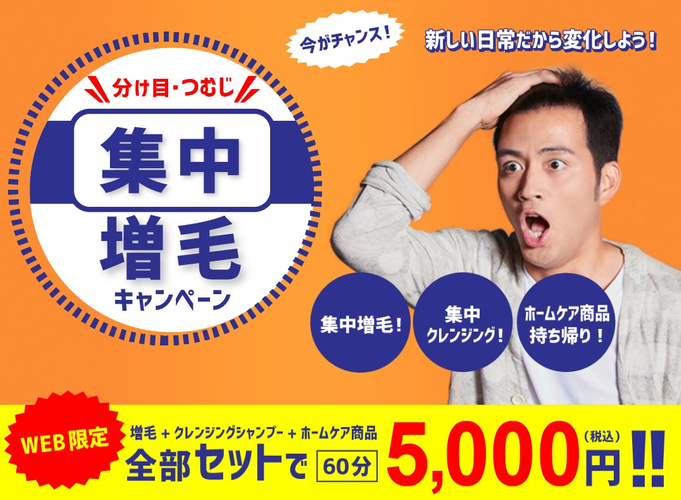 アートネイチャー 集中増毛キャンペーン 実施中 ｗｅｂ初回限定 ６０分５ ０００円 税込 ニコニコニュース