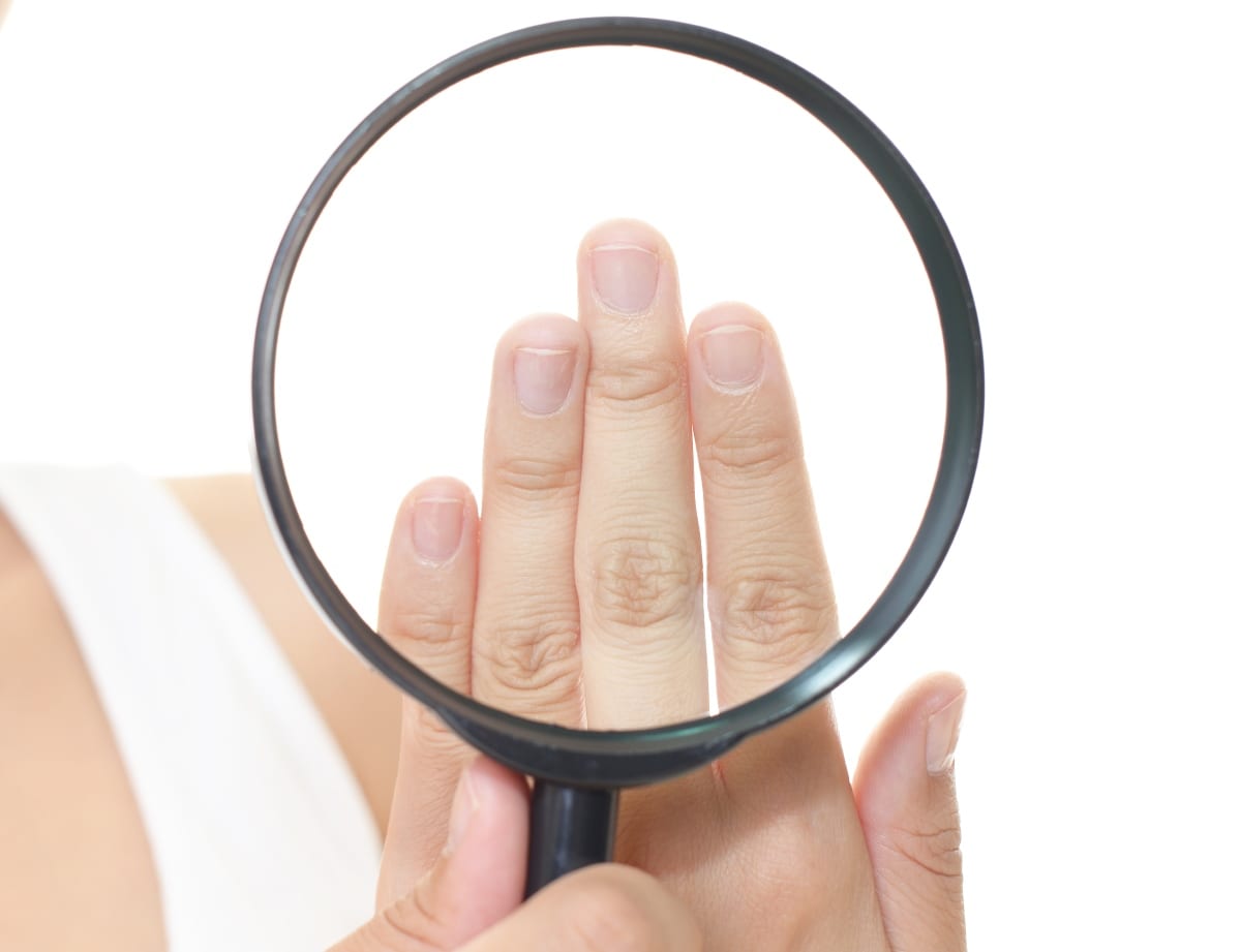 変形 線が入ることも 爪を見ると健康状態が分かる のは本当か ニコニコニュース