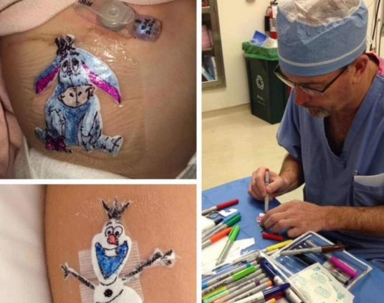 手術した子供たちを元気づけるため 治療後の患部に手描きのイラストパッチを付けてあげる医師 アメリカ ニコニコニュース