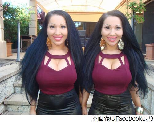 一心同体すぎる究極双子姉妹 整形に00万円以上費やし容姿一致目指す ニコニコニュース 一心同体すぎる究極双子姉妹 整形に00万円以上費やし容姿一致目指す ニコニコニュース